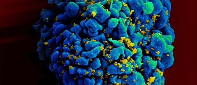 Cientistas conseguem ‘limpar’ DNA infectado de HIV