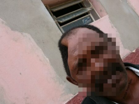 Após ser dado como morto e afundamento craniano, agricultor sobrevive em Betânia