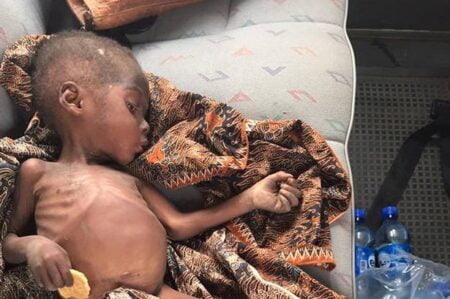 Garoto de 2 anos é encontrado desnutrido após família o abandonar por acreditar que ele era bruxo