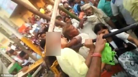 Escalpelamento: vídeo mostra adolescente perdendo couro cabeludo por causa de selfie