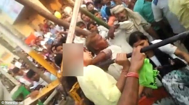 Escalpelamento: vídeo mostra adolescente perdendo couro cabeludo por causa de selfie