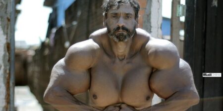 “He-Man” brasileiro: homem injeta óleo no corpo para aumentar os músculos