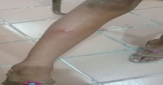 Descaso e negligência com criança em Hospital de Floresta
