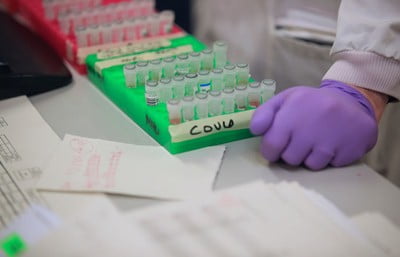 Carnaíba registra mais um caso confirmado de coronavírus