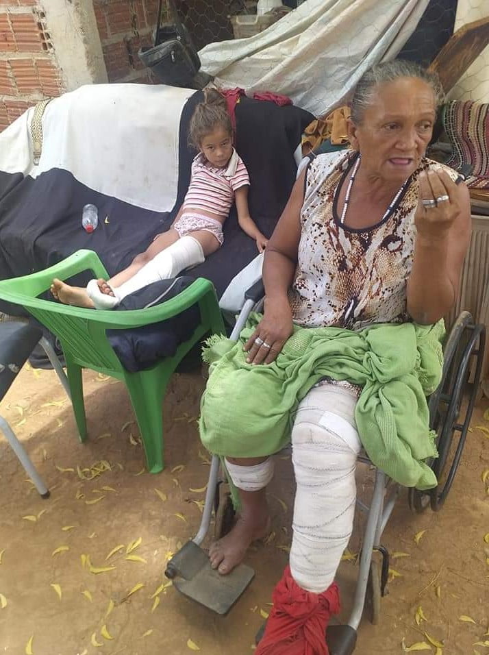 ST: Família vítima de acidente na PE-365, precisam de sua ajuda