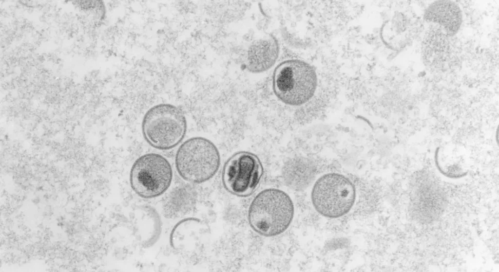 Varíola dos macacos